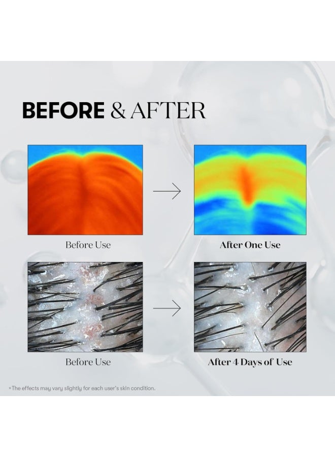 VT Pdrn Reedle Shot Hair Ampoule 100dl, Vegan Pdrn, Slow Aging, Scalp Treatment - Image 4